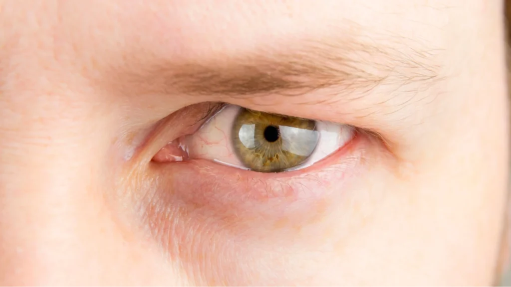 Why Do My Eyes Feel Heavy