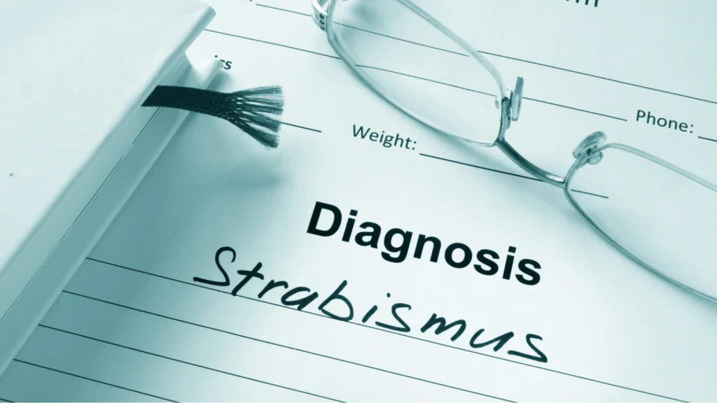 Strabismus Treatment, Causes and Symptoms