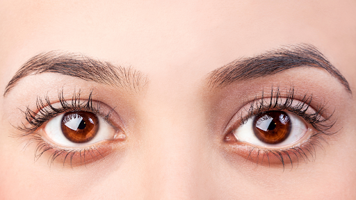 Close-up of a woman's wide-open brown eyes with visible white above and below the iris, a look associated with eyelid retraction in thyroid eye disease.